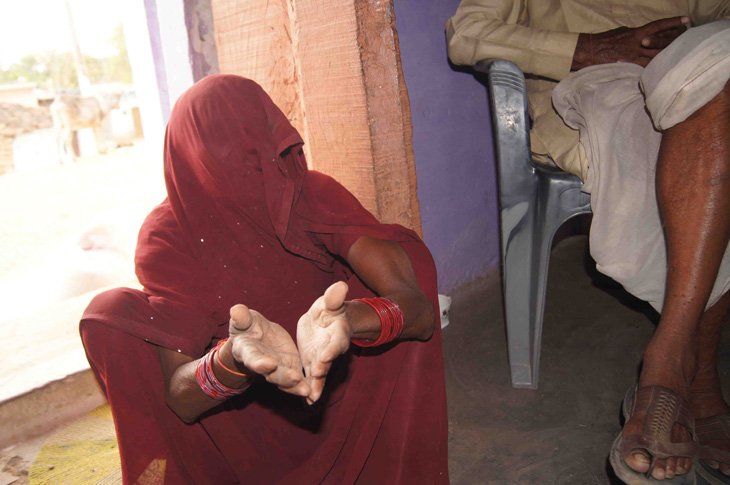 Indias Shame: Bundelkhand Woman Eats Mud For 12 Years To Survive