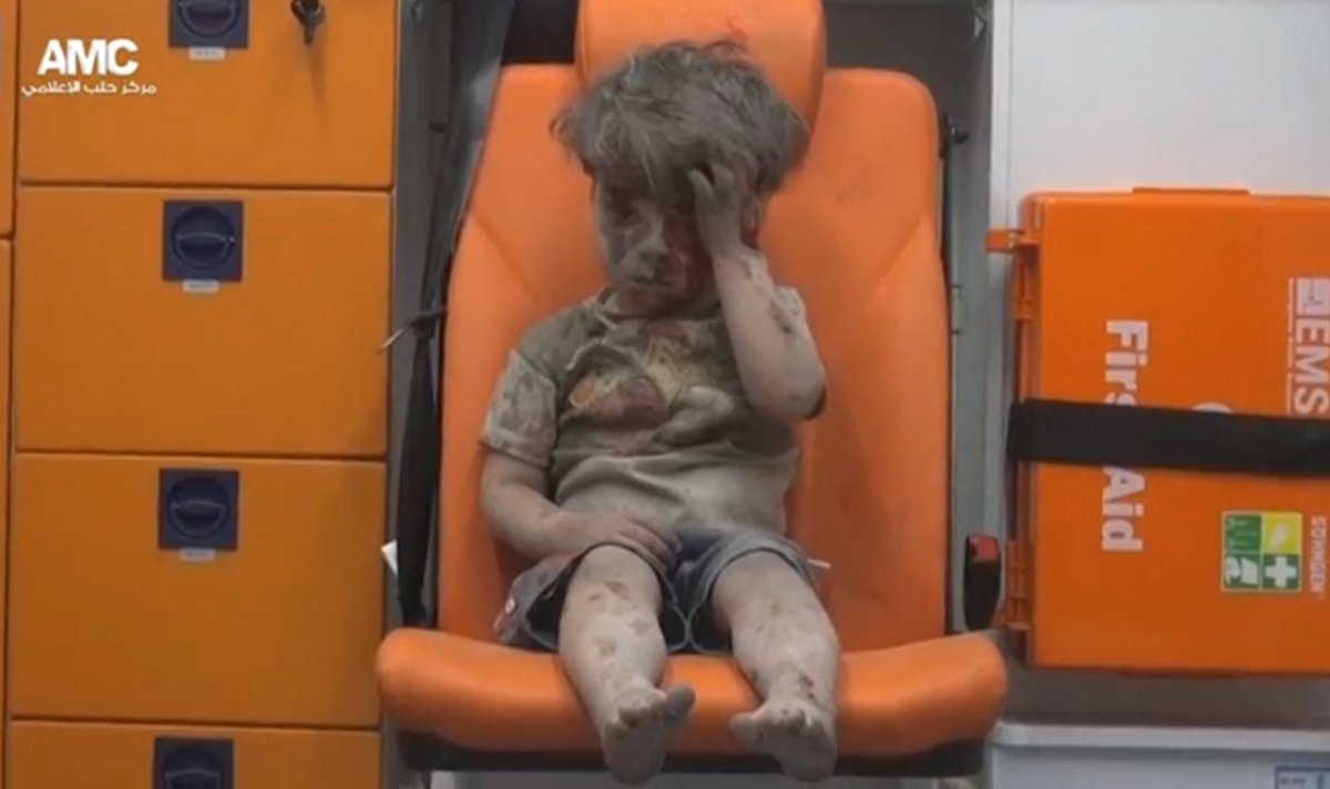 Covered In Dust With Blood On His Face, A Boy Reminds The World About The War In Syria