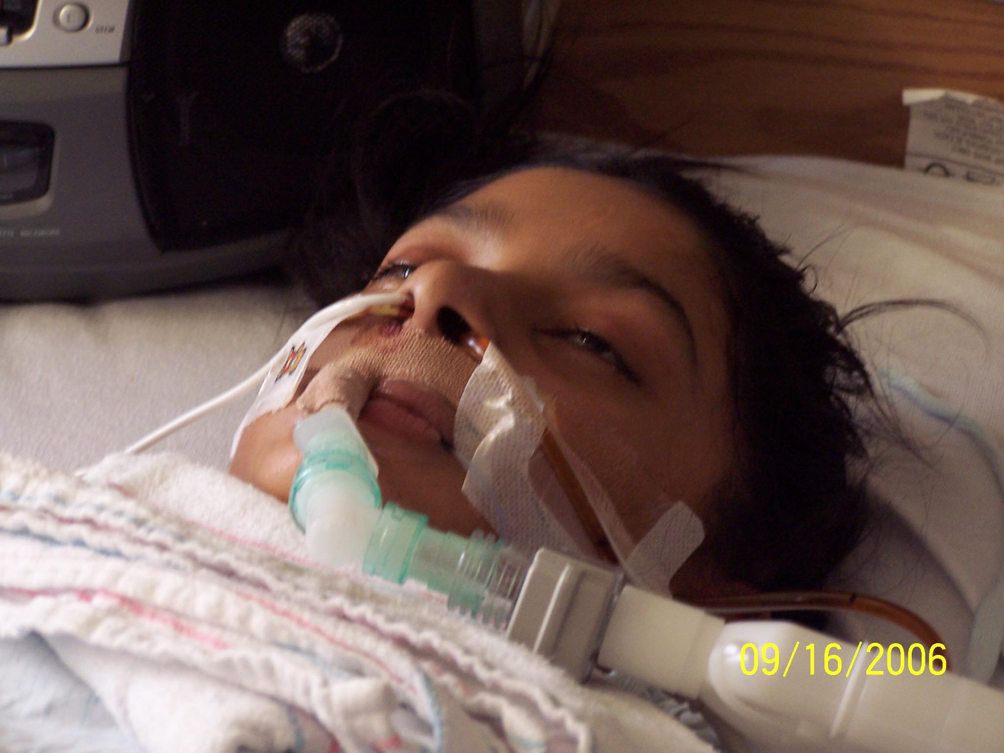 My Story: Theyd Pull The Plug From My Ventilator To Let Me Die, If I Didnt Show Any Improvements On My Birthday