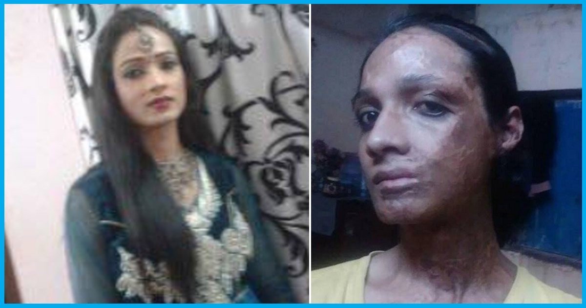 Gang Raped, Attacked With Acid & Humiliated: This Trans Woman Is In Need Of Your Help