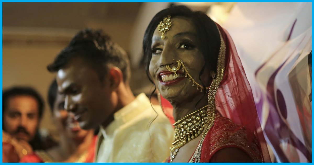 I Thought I Would Never Find Love: Acid Attack Survivor On Getting Married