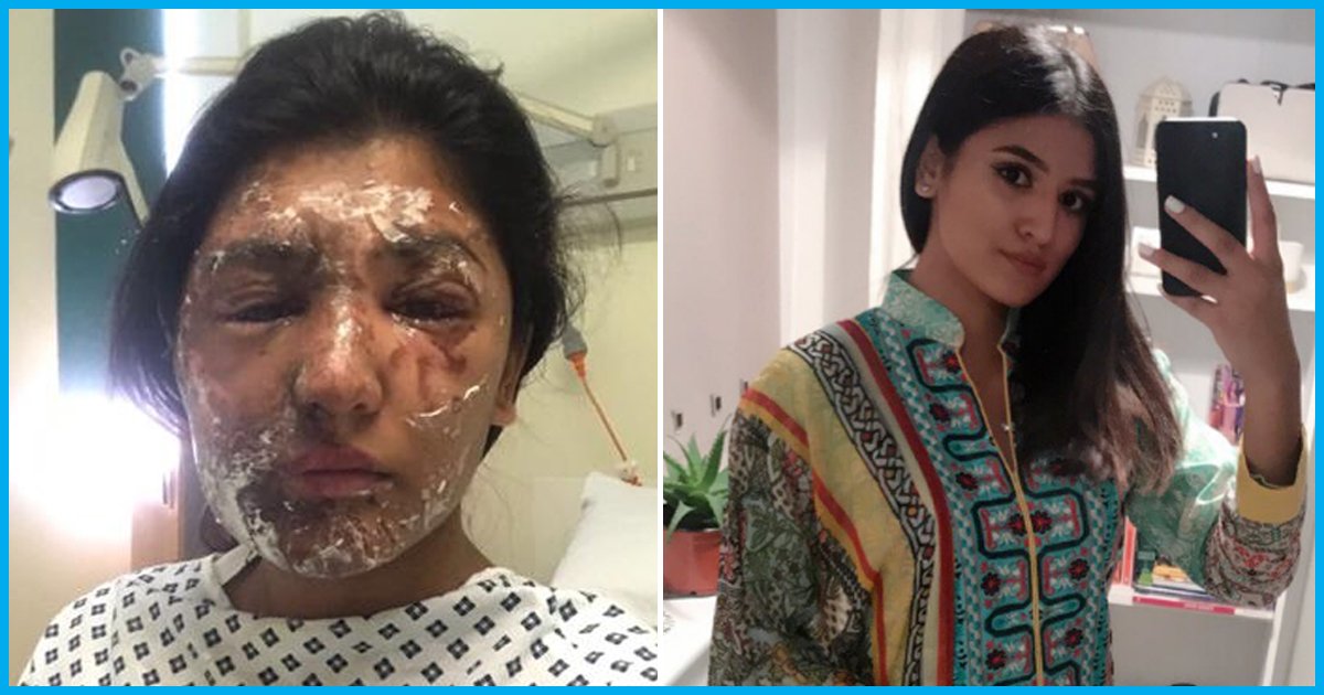 21-Yr-Old Acid Attack Survivor Shares Pictures After Her Recovery