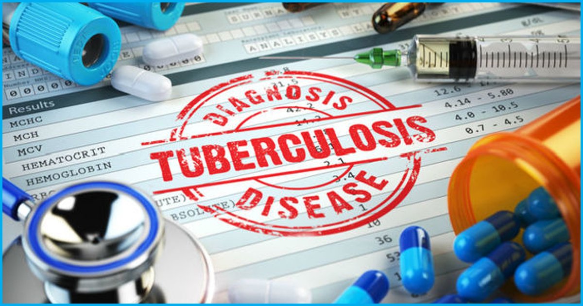 Indian Govt Plans To Eradicate TB Five Years Before Global Deadline By 2025, Will It Be Possible?