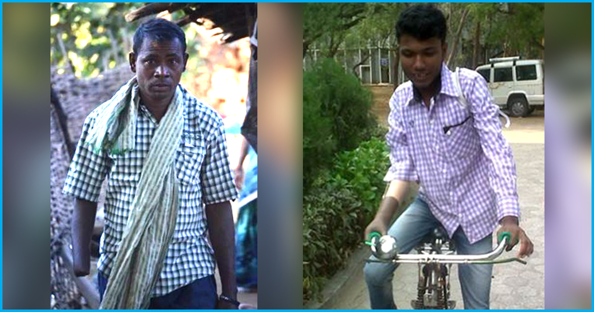 Hands Of These Two Men Were Chopped Off For Attempting To Escape From Human Traffickers