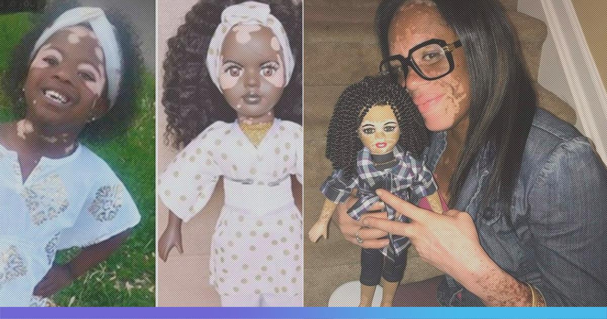 To Make Children More Confident In Their Own Skin, Artist Kay Black Makes Vitiligo Dolls
