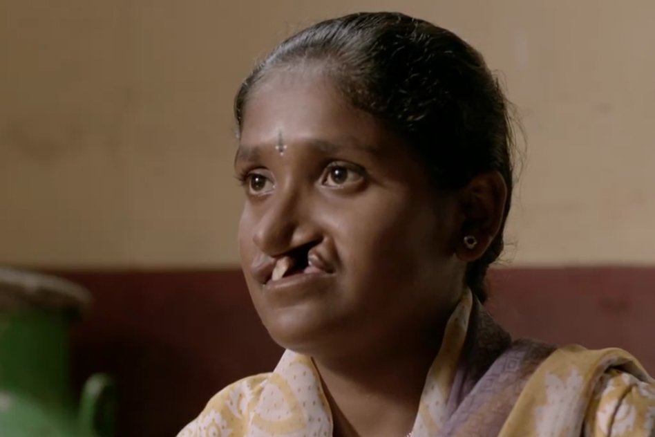 Video: Heart-Warming Story Of Jyothi, The Girl Who Didnt Want To Look In The Mirror