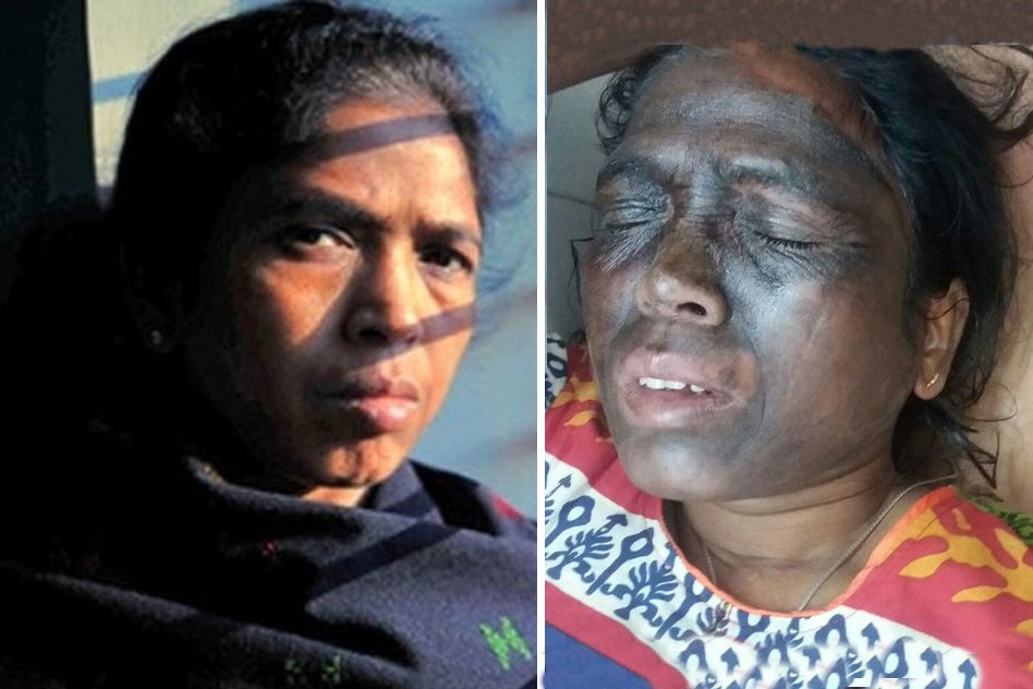 The Attack On Soni Sori And Why Chhatisgarh Police Fear Her