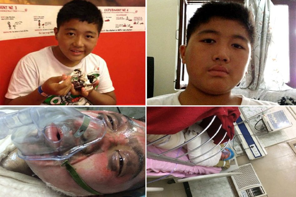Tibetan Teen Dies After Setting Himself On Fire To Free Tibet, Heres A Brief History Of The Issue