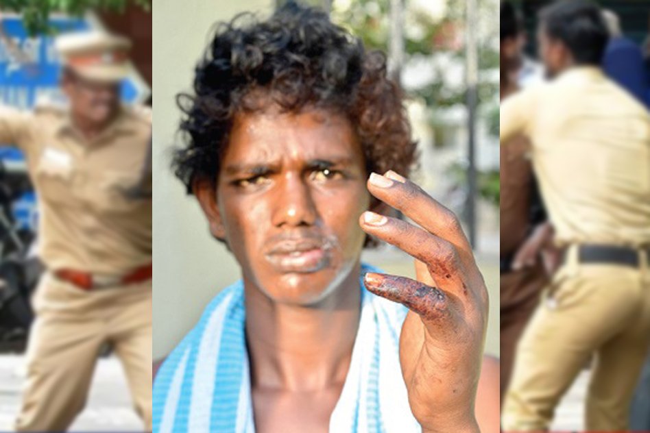 Cops Brutally Thrashed My Son, Said Wrong Person & Gave Him Rs 10 Says The Mother Of The Victim