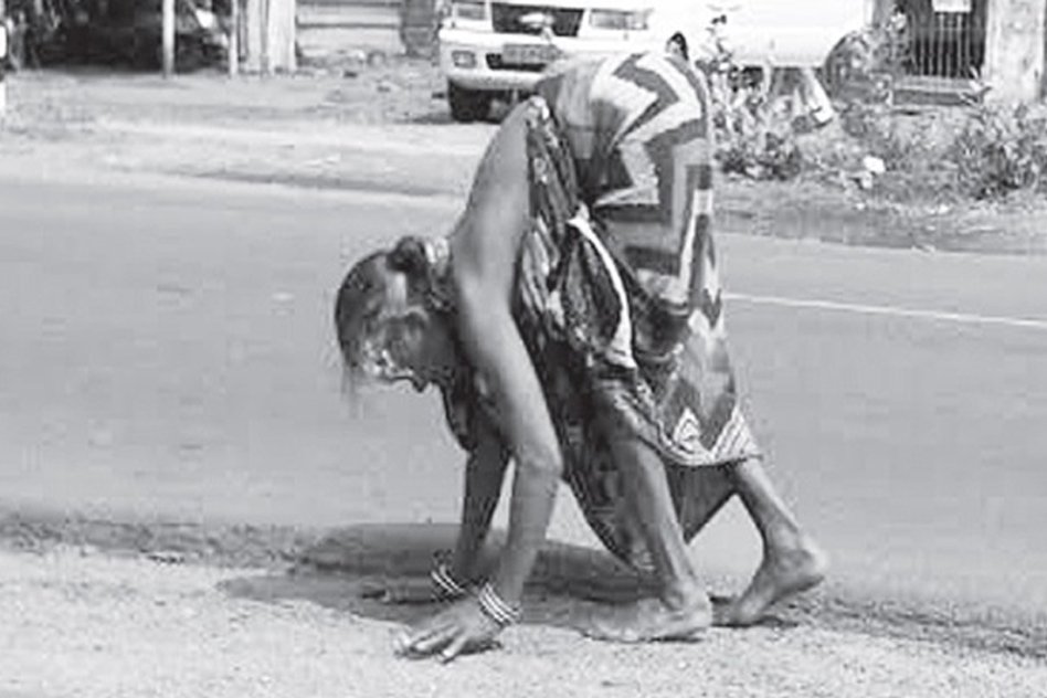 The Sad Story Of A Physically Challenged Woman Who Crawls 2 Km For Rs 300 Pension