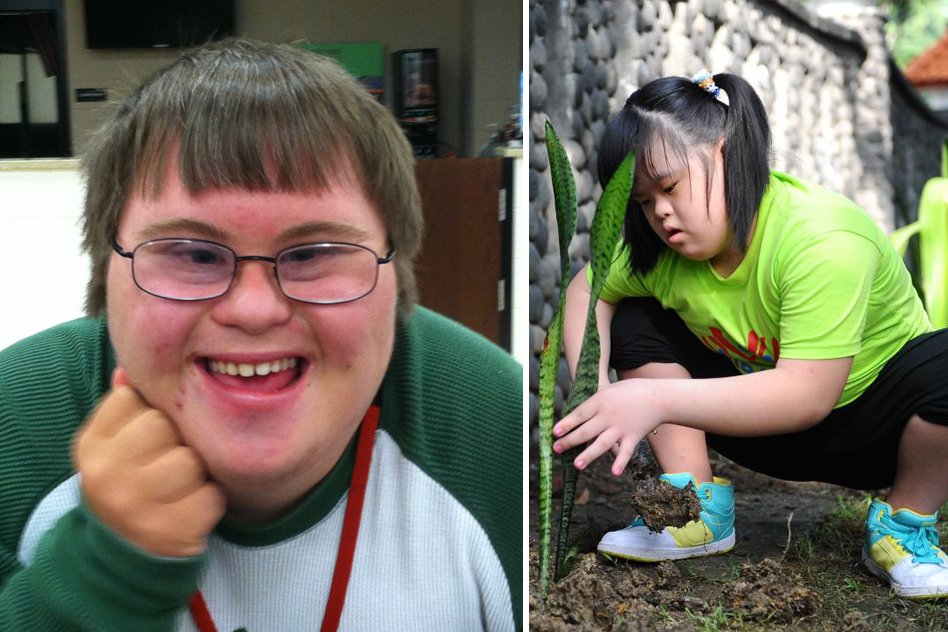 All You Need To Know About World Down Syndrome Day