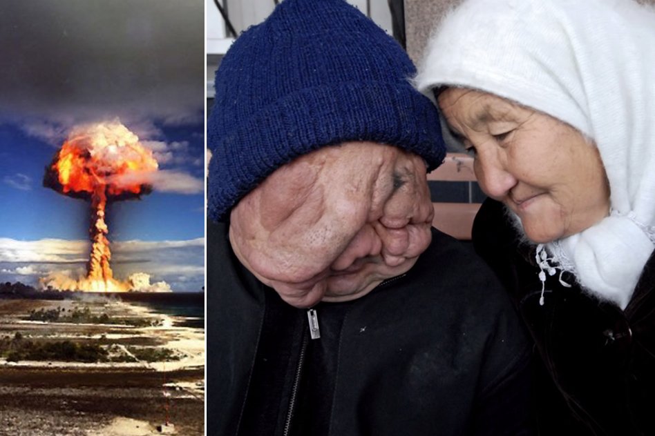 [Watch/Read] The Worst Nuclear Test: How USSR Nuclear Tests Affects Million Of Peoples Lives