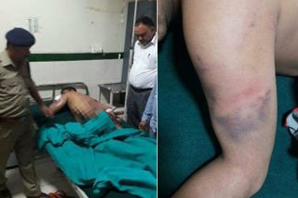 Electricity Department Employee Brutally Beaten By Police. Will The Same Police Do Policing On Police?