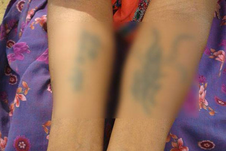 Rajasthan: Husband And In-Laws Gang-Rape Woman. Tatoo Her Forehead And Arms With Abuses.
