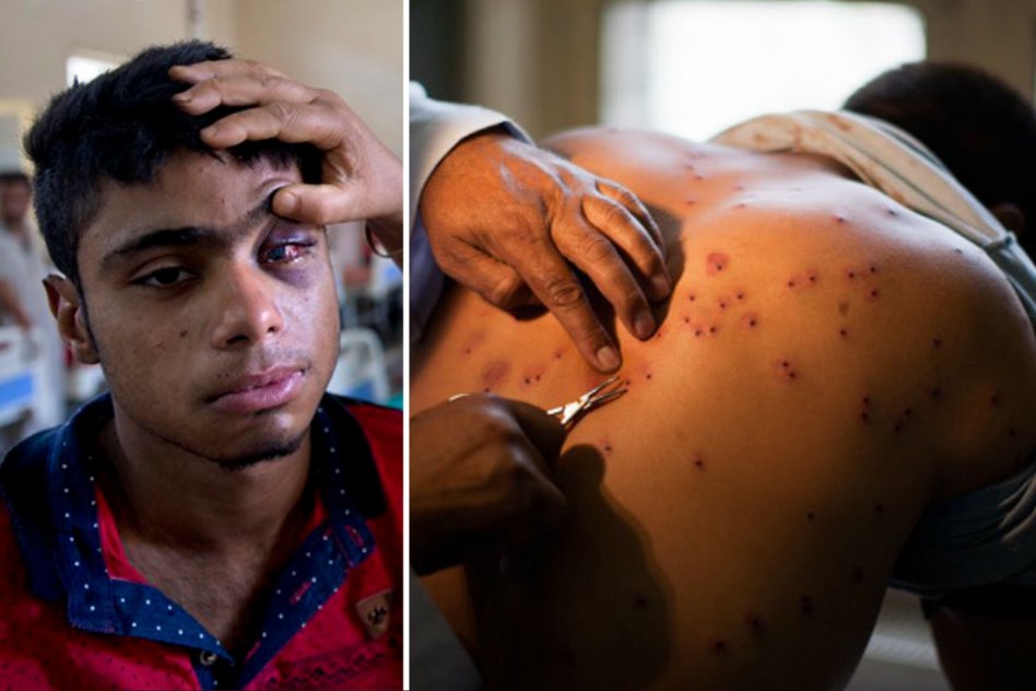 [Video] An Appeal Of An Eye Specialist Against The Use Of Pellet Guns By The Armed Forces