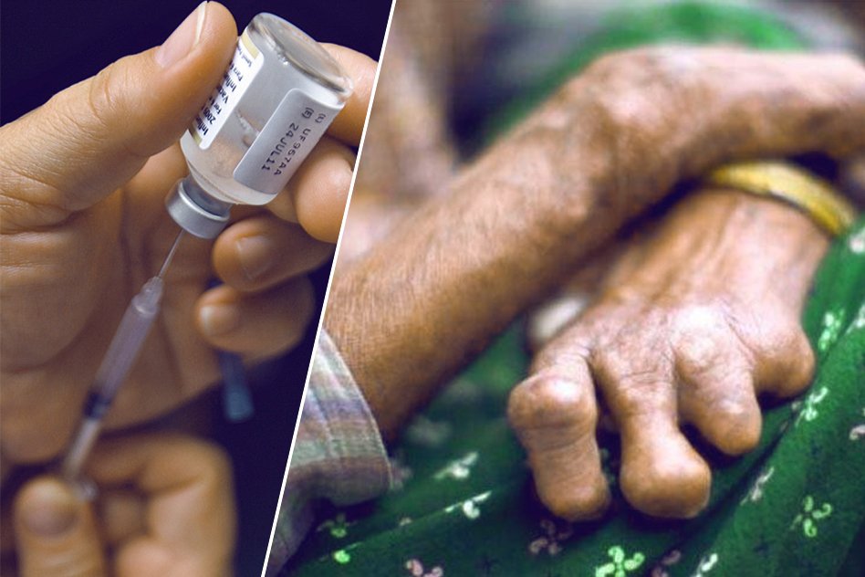 India Has Invented The First Vaccine For Leprosy, Bihar And Gujarat Get The First Dose