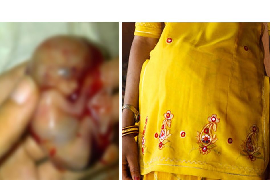 Chhattisgarh Woman Carrying Dead Foetus For Five Days Dies Of Infection After Being Denied Treatment
