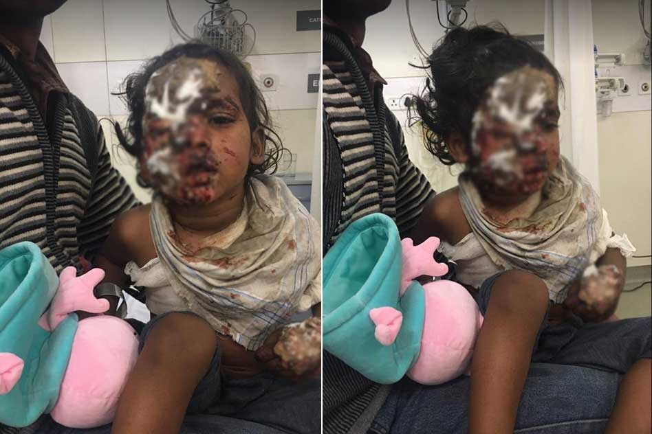 2-Yr-Old Son Attacked With Acid After His Mother Rejects Neighbours Sexual Advances