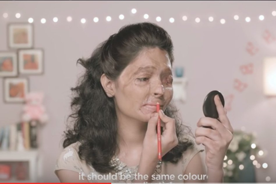 [Watch] Learn Beauty Tips From An Acid Attack Survivor With A Powerful Message