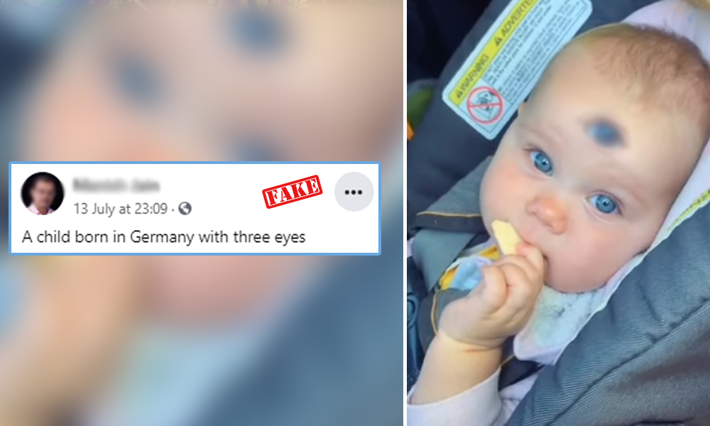 Fact Check: Baby Born With 3 Eyes In Germany? 