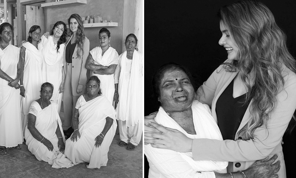 I Wanted To Redefine Beauty Says Social Entrepreneur Who Took Indias Acid Attack Survivors To Milan Fashion Week