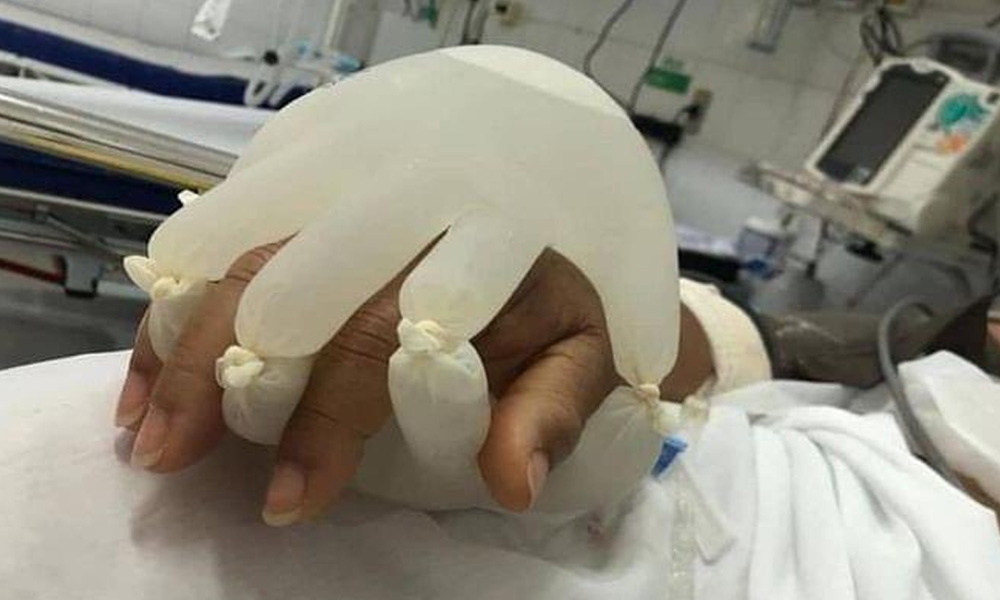 Brazilian Nurses Use Water-Filled Gloves To Simulate Human Touch For Isolated COVID-19 Patients
