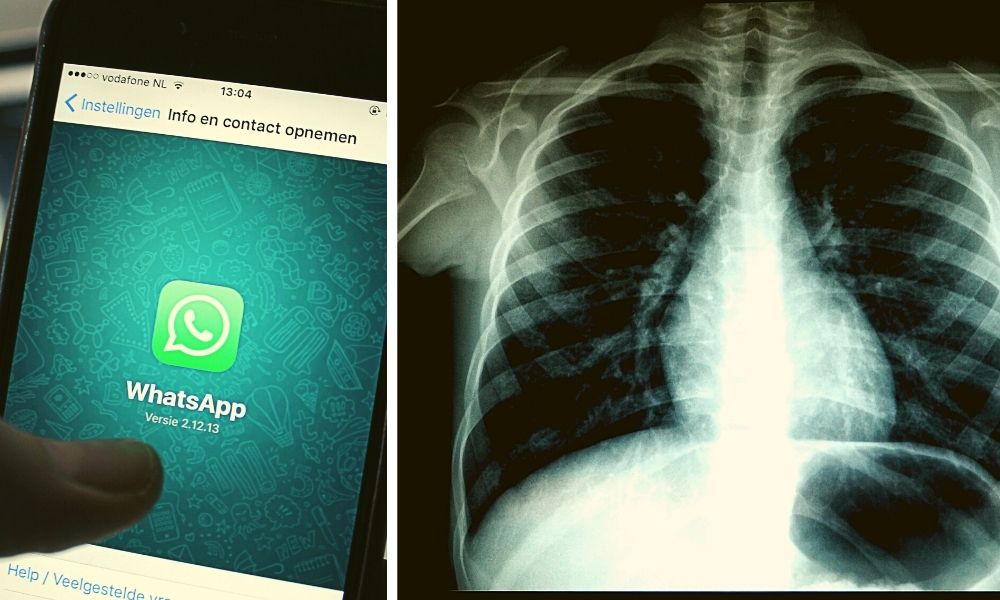 AI To Help Manage COVID In Rural Areas By Reading X-rays Via Whatsapp