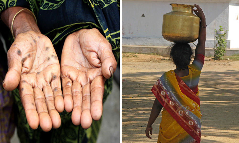 Over 1 Million Lives Lost In 30 Years: How Arsenic Poisoning Is Wreaking Havoc In India