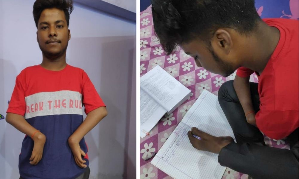 Disability No Excuse: Teen Writes XII Board Exams With Toes, Scores 70%