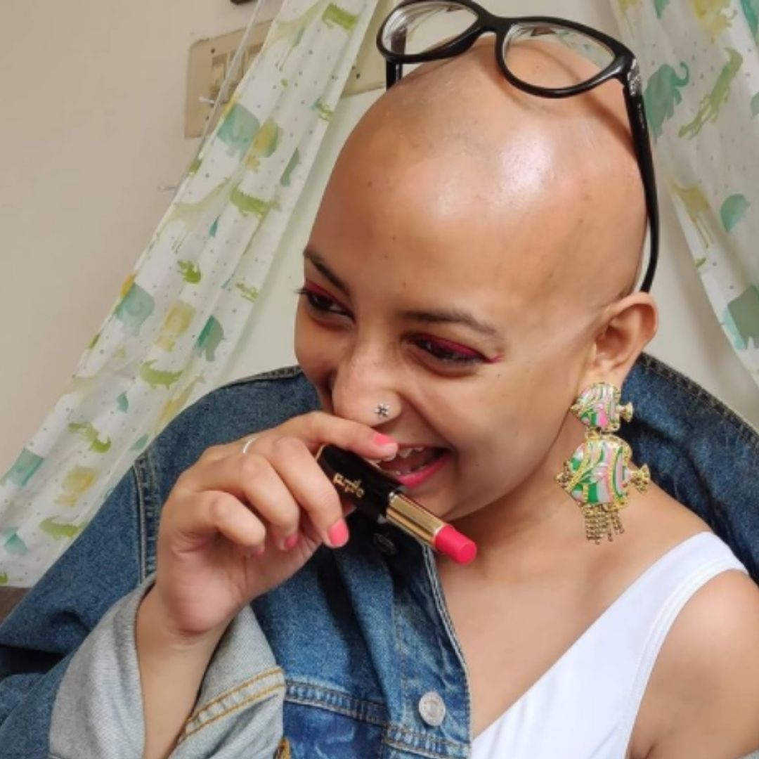 My Story: From Fighting Self-Pity To Conquering Self-Confidence, My Life With Hair Loss