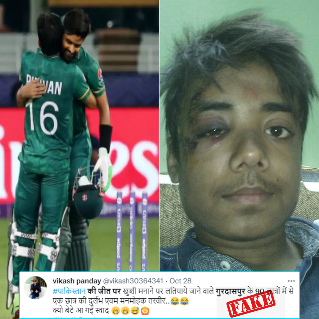 Was This Boy Beaten Up For Celebrating Pakistans Win Against India? No, Viral Image Is From 2016
