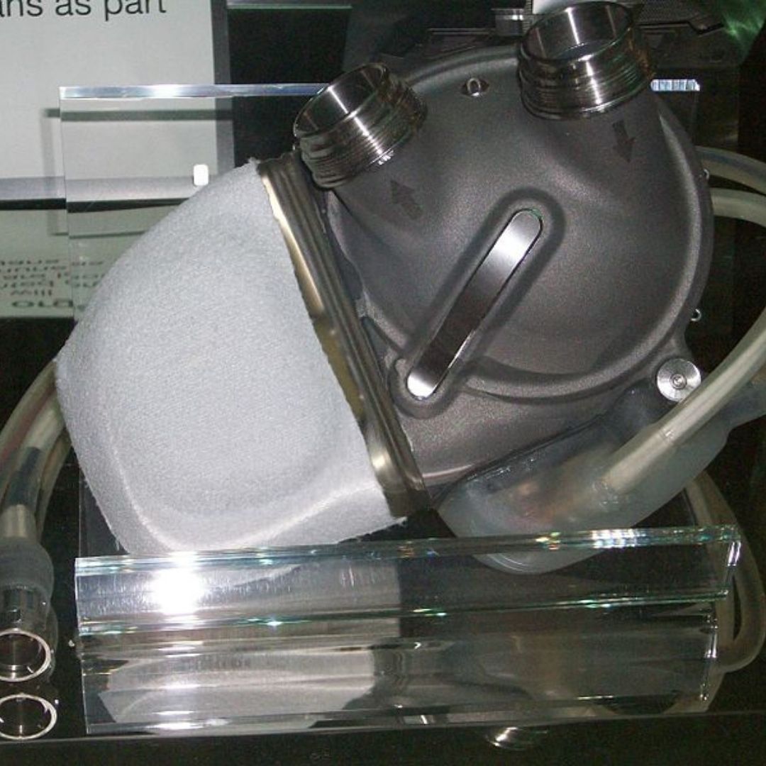 On This Day, Worlds First Artificial Heart Was Successfully Implanted Into Human Body
