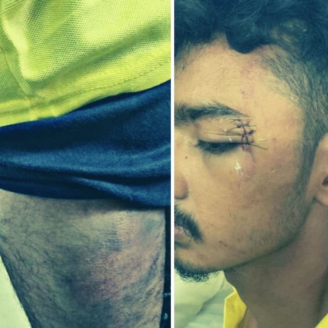 TN Law Student Who Was Questioned For Not Wearing Mask, Assaulted By Police; 8 Cops Booked