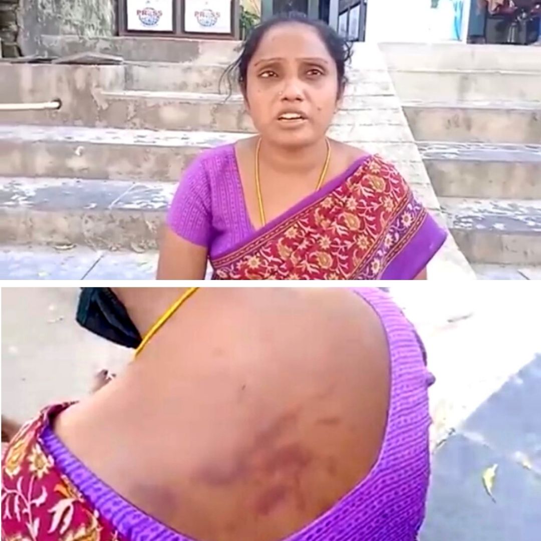Andhra Pradesh Cop Abuses, Tortures Dalit Woman In Custody; Suspended