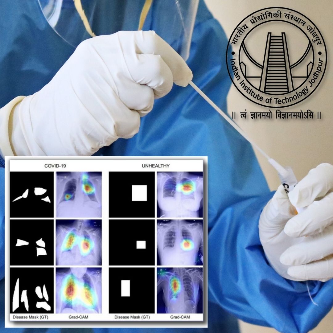 IIT Steps Up Again, Invents New Technique To Diagnose COVID Using Chest X-Ray