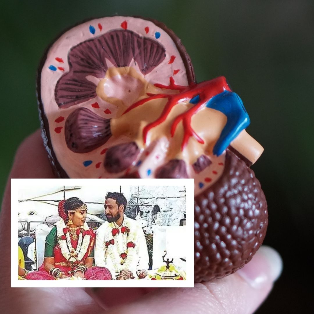 Two Kidney Recipients, Aged 30, Get Married In Bengaluru On Valentines Day