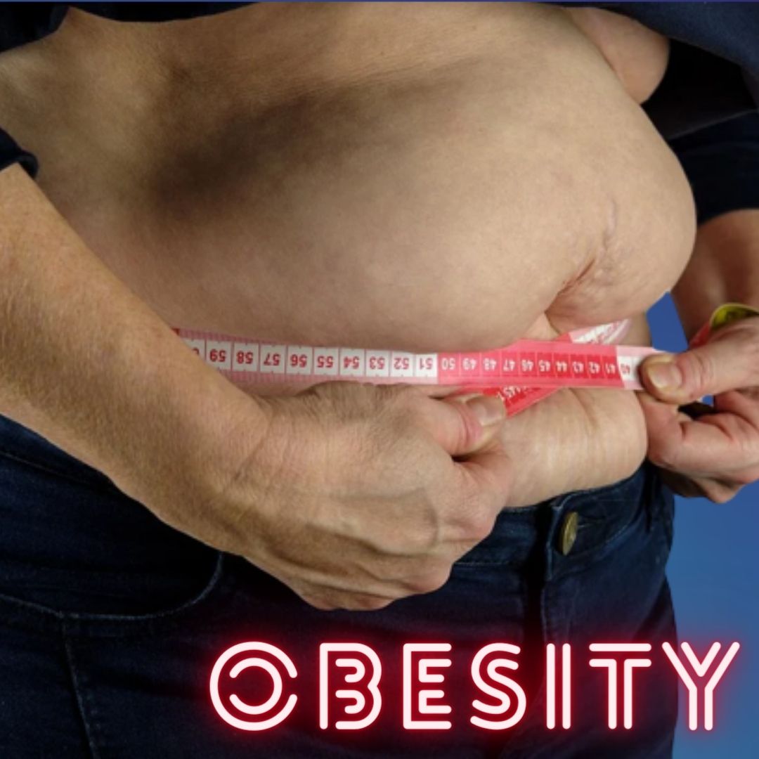 Obesity Can Lead Up To 53 Diseases; How Is It Emerging As An Epidemic?