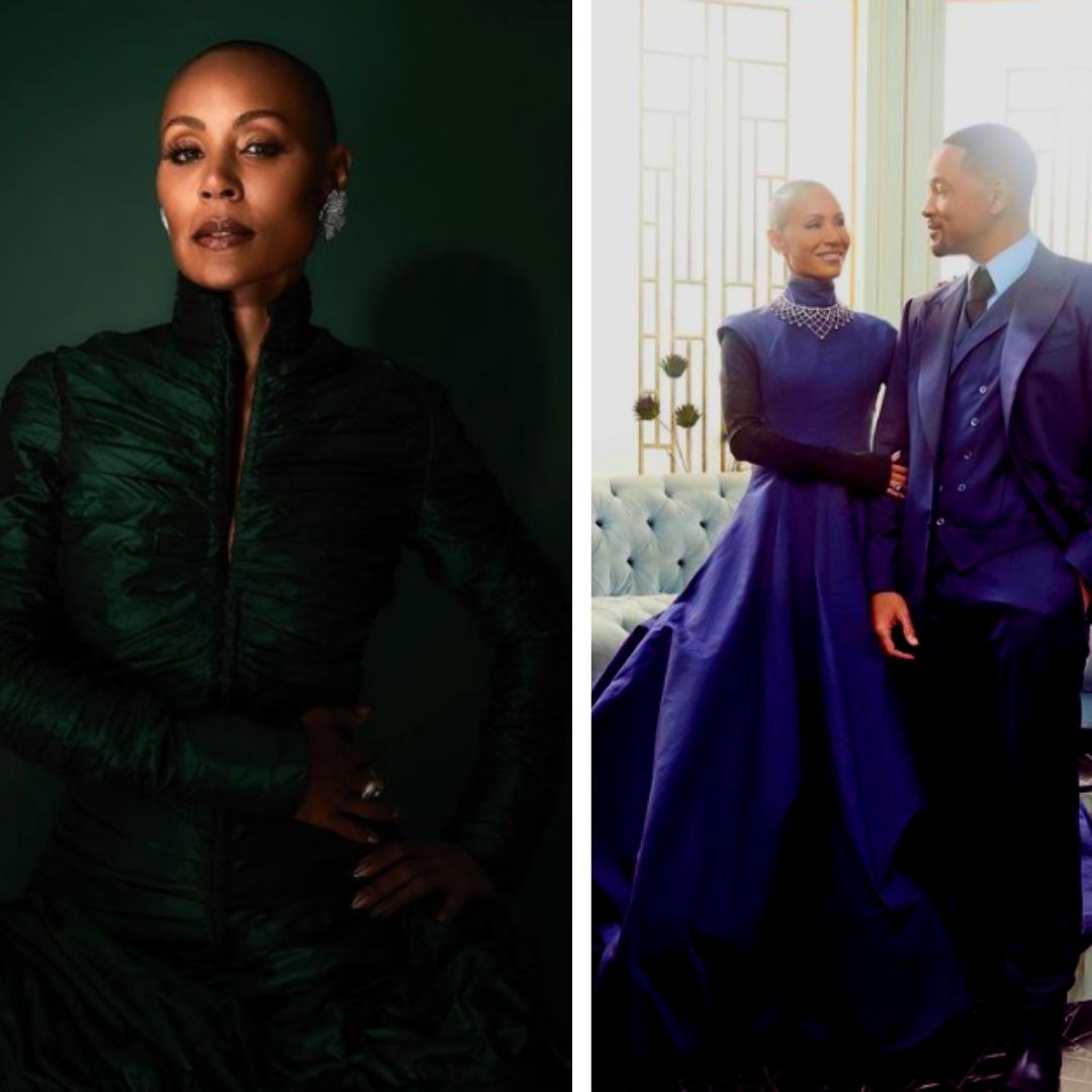 Jada Pinkett Smiths Struggle With Alopecia: All You Need To Know About The  Condition