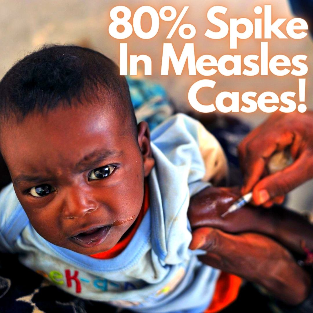 Concerning! Heres How Perfect Storm Pandemic Caused 80% Spike In Measles Cases Worldwide