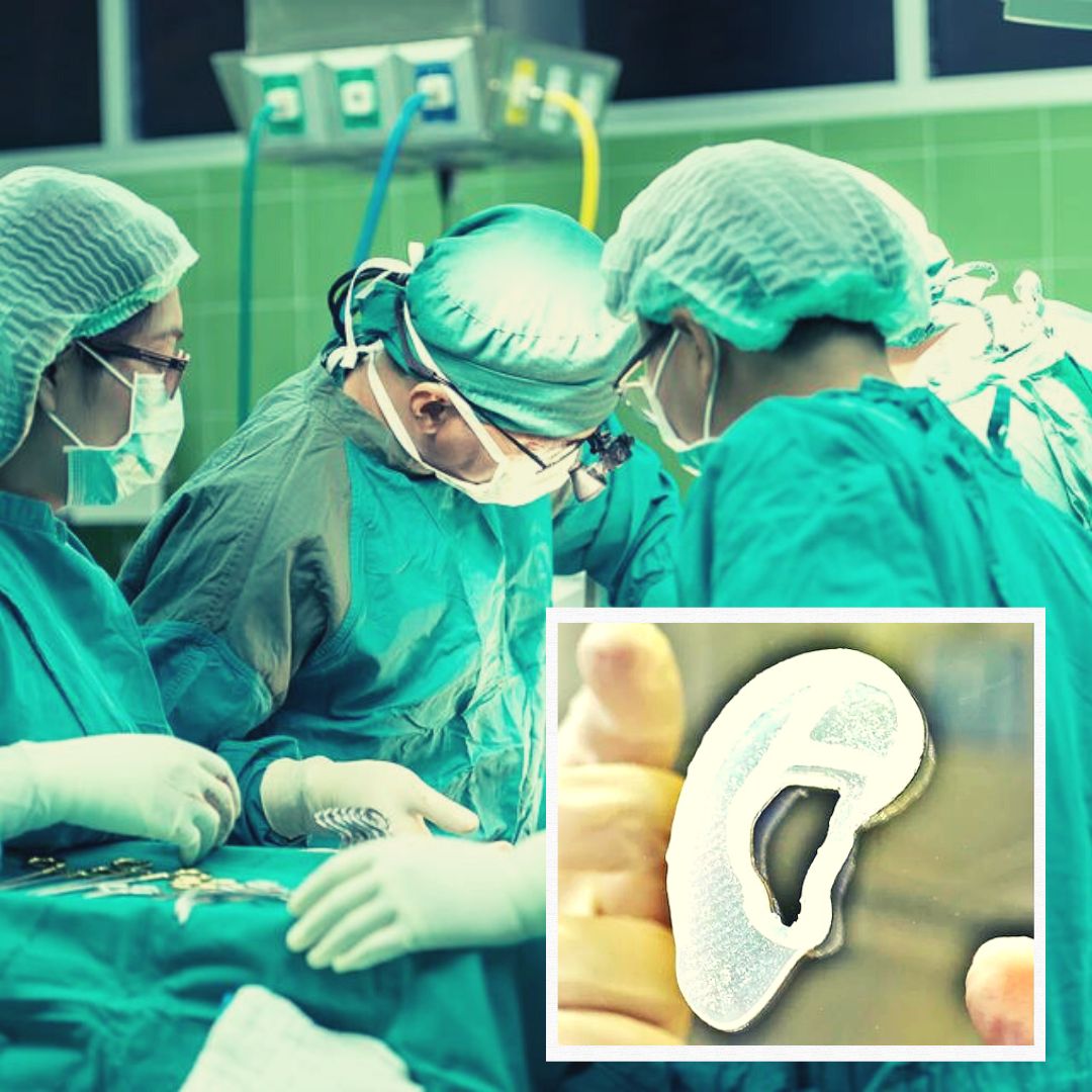 Medical Breakthrough! Woman Gets First-Ever 3D Printed Ear Made From Her Own Tissue