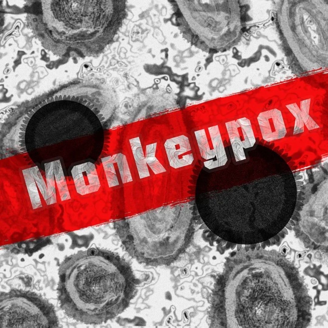 Monkeypox: Centre Issues Fresh Guidelines; Includes Three-Layered Mask, 21-Day Isolation