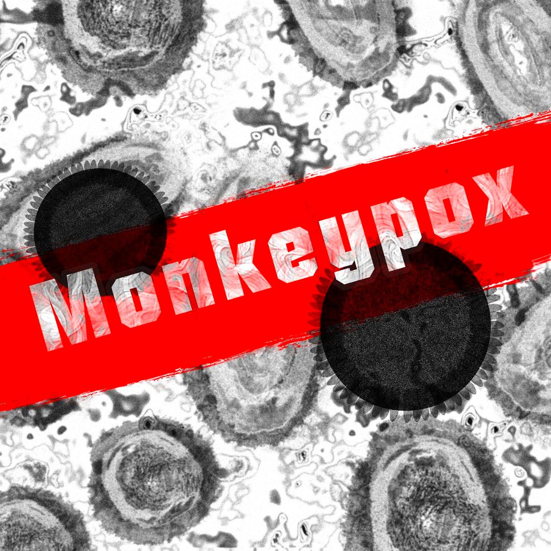 Alarming! Delhi Reports Third Monkeypox Case, 8 In India So Far: Health Minister