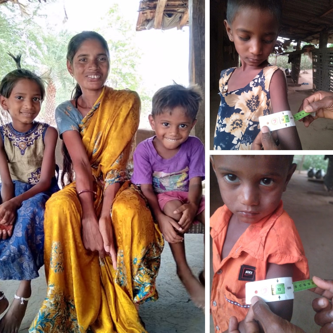 Malnourished Siblings In Telangana Settlement Lead Healthy Lives With Sustained Support