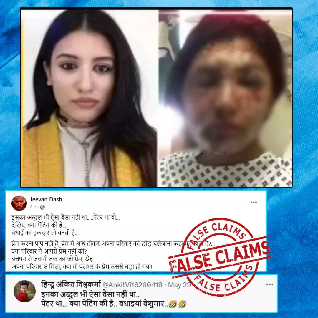 Does This Image Of An Acid Attack Victim Contain The Love-Jihad Angle? No, Viral Claim Is False