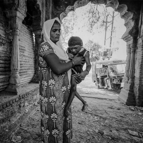 Heart-Wrenching Images Showing The Devastating Affects Of The Bhopal Gas  Tragedy Even After 32 Years
