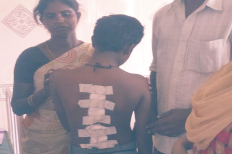 Maharashtra: 13-Yr-Old Dalit Boy Beaten Up, Paraded Naked 