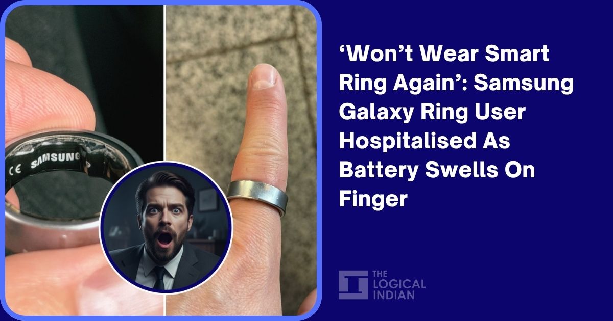 ‘Won’t Wear Smart Ring Again’: Samsung Galaxy Ring User Hospitalised As ...